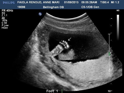 FAIOLA RENOUDANNE MARIE20130109090528154